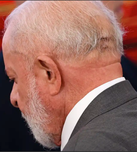 Procedimento do presidente é concluído “com sucesso”, diz Dr. Kalil 