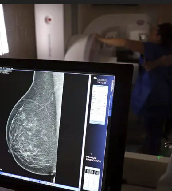 Entidades médicas pedem faixa etária maior para mamografia de rastreio