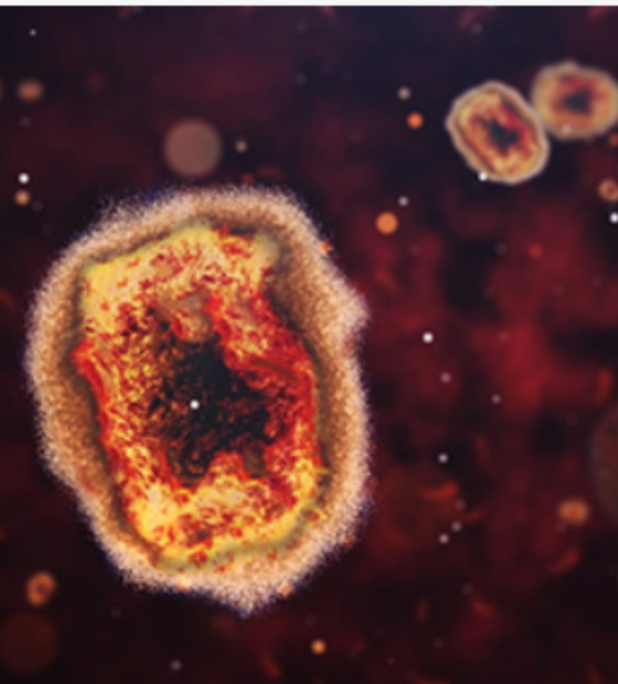 Paciente com diagnóstico de Mpox morre em Belém