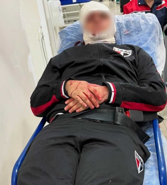 Torcedores atingidos por placa no MorumBis permanecem internados após passarem por cirurgias