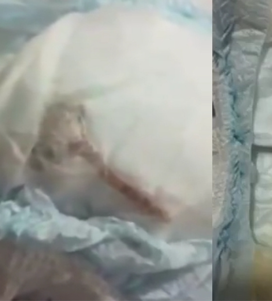 Mãe encontra rato morto dentro de fralda do filho; Delegacia do Consumidor investiga