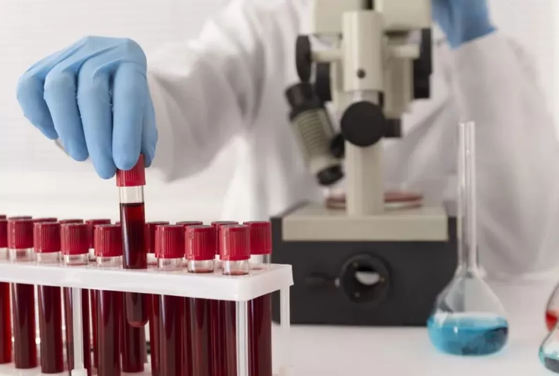 CFM libera tratamento com o próprio sangue para lesões e desgaste nas articulações