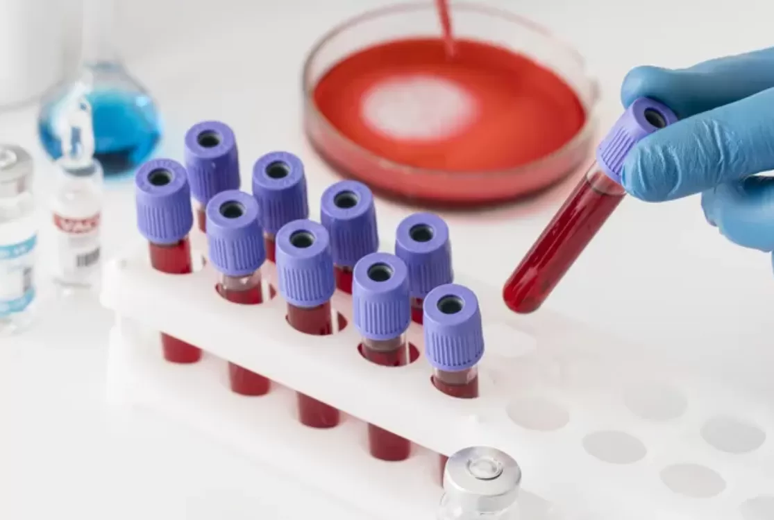 Câncer: exame de sangue que detecta mais de 50 tipos da doença chega ao país